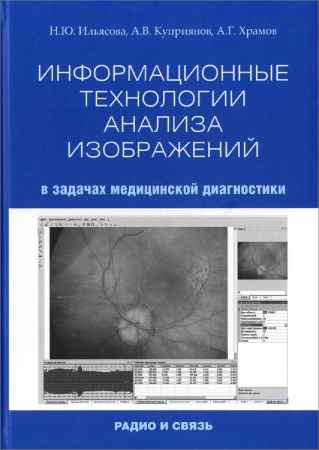 Информационные технологии анализа изображений в задачах медицинской диагностики на Развлекательном портале softline2009.ucoz.ru